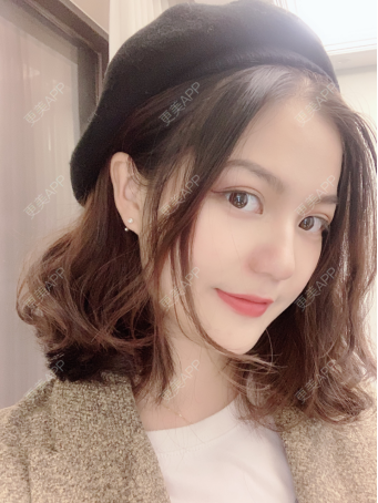 更美 - 薄荷喵&的隆鼻经验 | 隆鼻 | 武汉