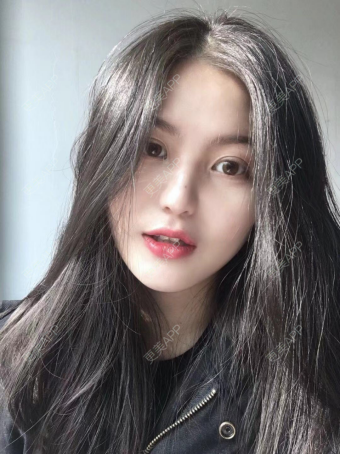 更美 - 薄荷喵&的隆鼻经验 | 隆鼻 | 武汉