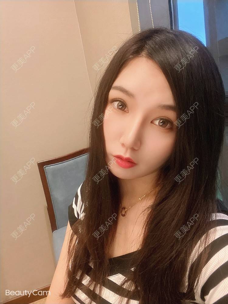 更美 - 傻傻傻分不清的硅胶垫下巴经验 | 硅胶垫下巴 | 上海