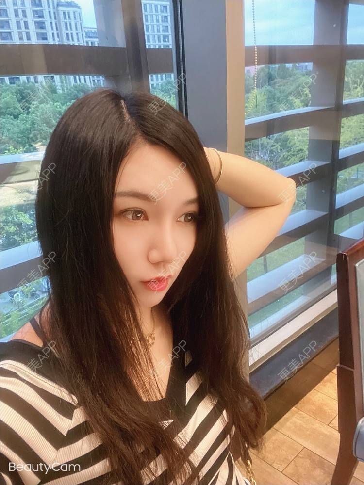 更美 - 傻傻傻分不清的硅胶垫下巴经验 | 硅胶垫下巴 | 上海