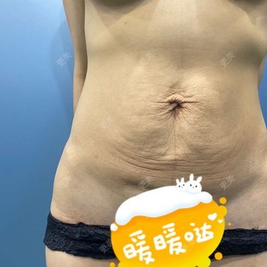 长星媛