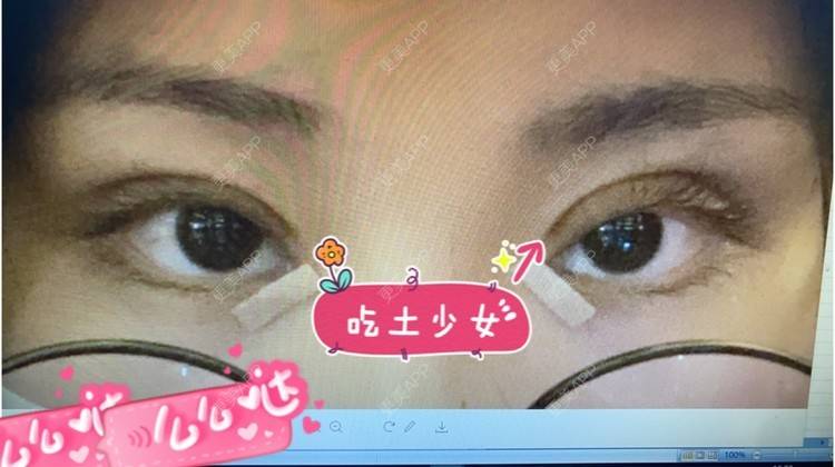 更美 - if you if的开内眼角经验 | 上海 | 眼部多项