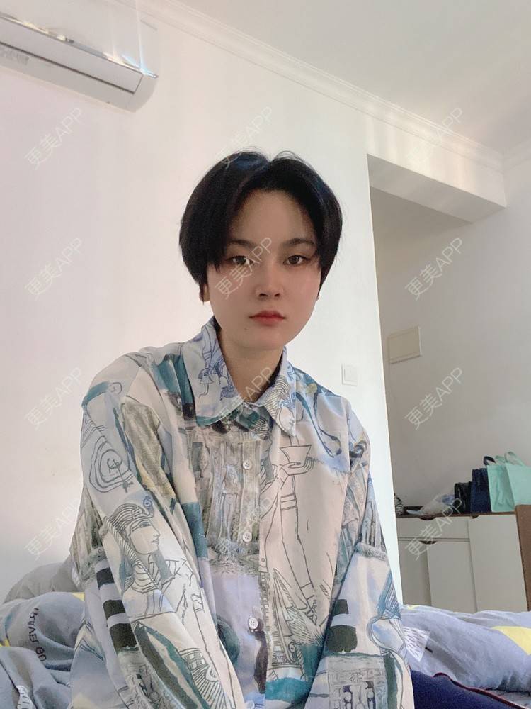 更美 - 全酷开区的下巴经验 | 下巴 | 膨体垫下巴 | 缩下巴 | 下巴截骨 | 宽下巴矫正 | 手术缩鼻头 | 自体软骨垫鼻尖 | 硅胶垫下巴 | 胶原蛋白丰下巴 | 人工骨垫下巴 | 鼻小柱延长 | 耳软骨隆鼻