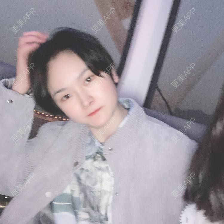 更美 - 全酷开区的下巴经验 | 下巴 | 膨体垫下巴 | 缩下巴 | 下巴截骨 | 宽下巴矫正 | 手术缩鼻头 | 自体软骨垫鼻尖 | 硅胶垫下巴 | 胶原蛋白丰下巴 | 人工骨垫下巴 | 鼻小柱延长 | 耳软骨隆鼻
