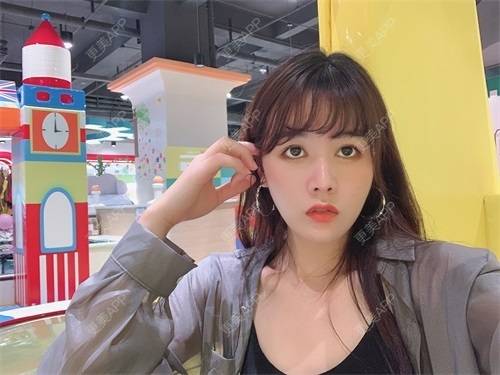 更美 - 更美用户8SCdWhYpRY的肋软骨隆鼻经验 | 成都 | 肋软骨隆鼻