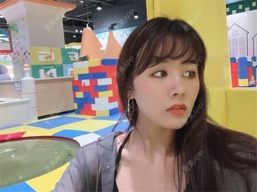 更美 - 更美用户8SCdWhYpRY的肋软骨隆鼻经验 | 成都 | 肋软骨隆鼻