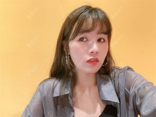 更美 - 更美用户8SCdWhYpRY的肋软骨隆鼻经验 | 成都 | 肋软骨隆鼻