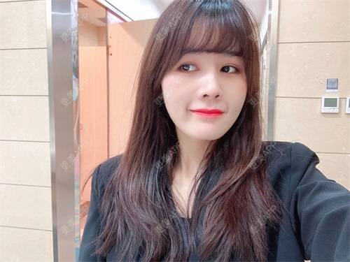 更美 - 更美用户8SCdWhYpRY的肋软骨隆鼻经验 | 成都 | 肋软骨隆鼻