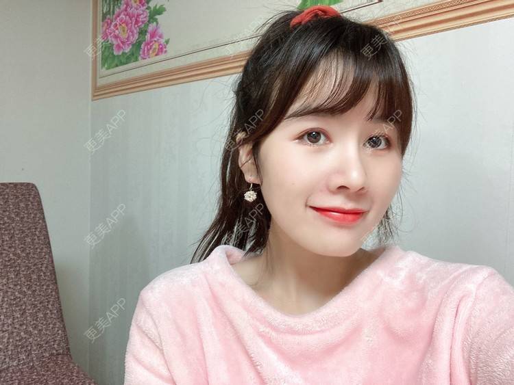 更美 - 更美用户8SCdWhYpRY的肋软骨隆鼻经验 | 成都 | 肋软骨隆鼻