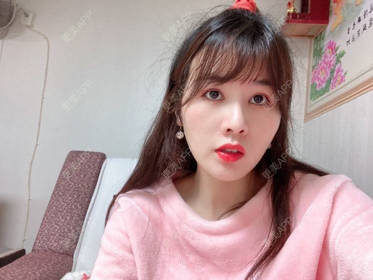 更美 - 更美用户8SCdWhYpRY的肋软骨隆鼻经验 | 成都 | 肋软骨隆鼻