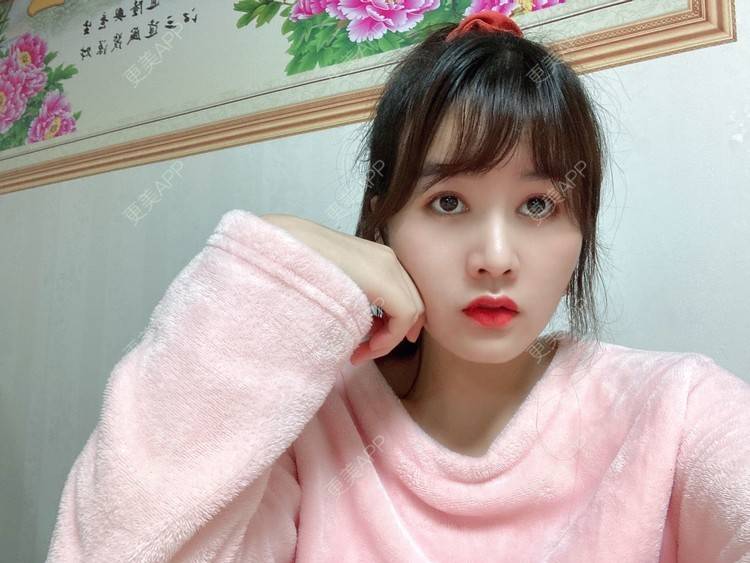 更美 - 更美用户8SCdWhYpRY的肋软骨隆鼻经验 | 成都 | 肋软骨隆鼻