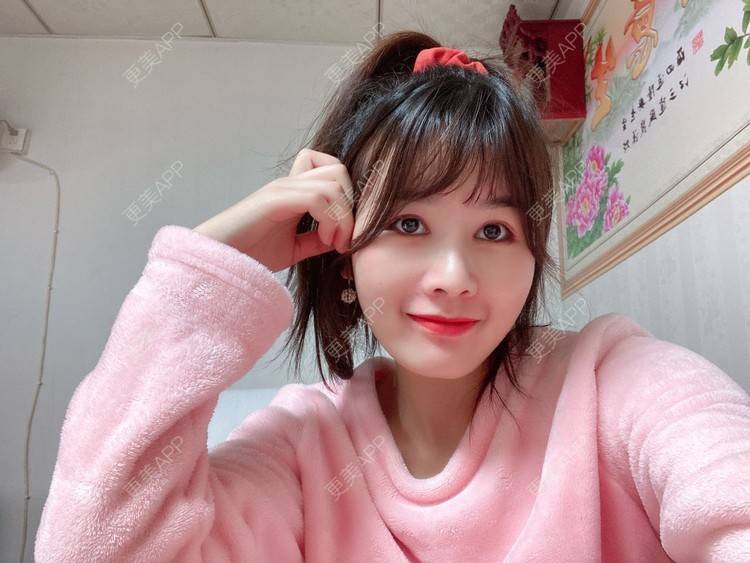 更美 - 更美用户8SCdWhYpRY的肋软骨隆鼻经验 | 成都 | 肋软骨隆鼻