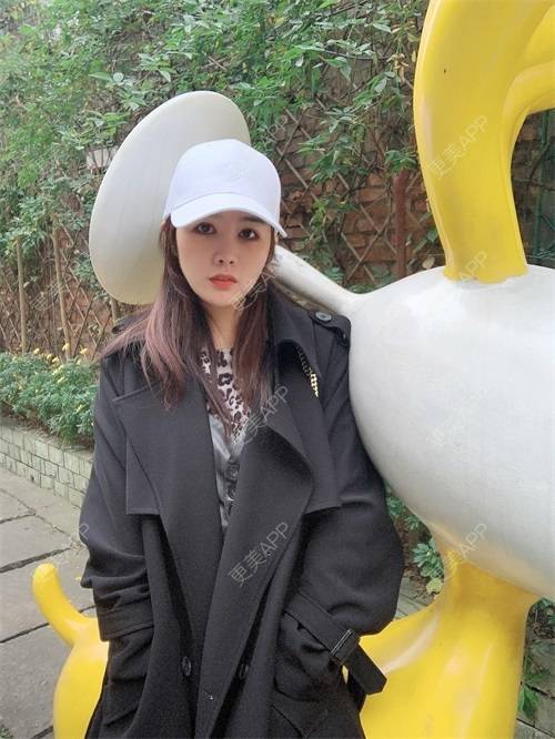 更美 - 更美用户8SCdWhYpRY的肋软骨隆鼻经验 | 成都 | 肋软骨隆鼻