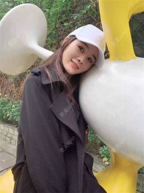更美 - 更美用户8SCdWhYpRY的肋软骨隆鼻经验 | 成都 | 肋软骨隆鼻