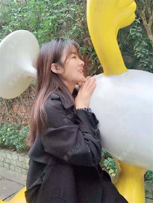 更美 - 更美用户8SCdWhYpRY的肋软骨隆鼻经验 | 成都 | 肋软骨隆鼻