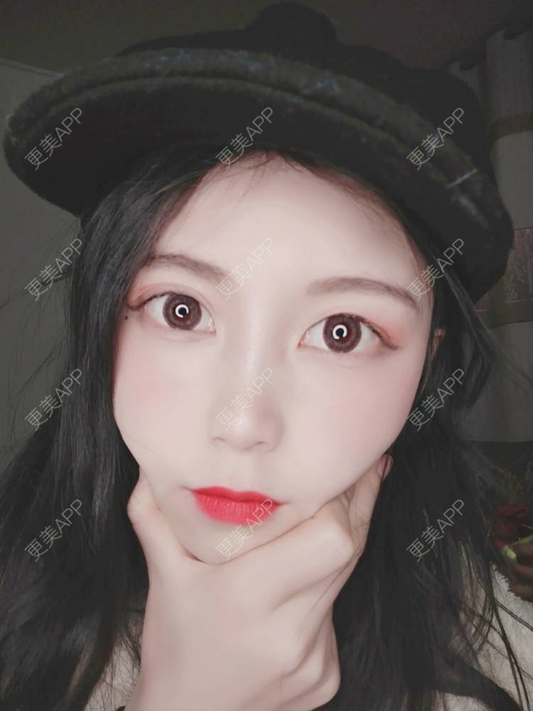 更美 - 更美用户6tbKoy0yru的热玛吉经验 | 广州 | 热玛吉