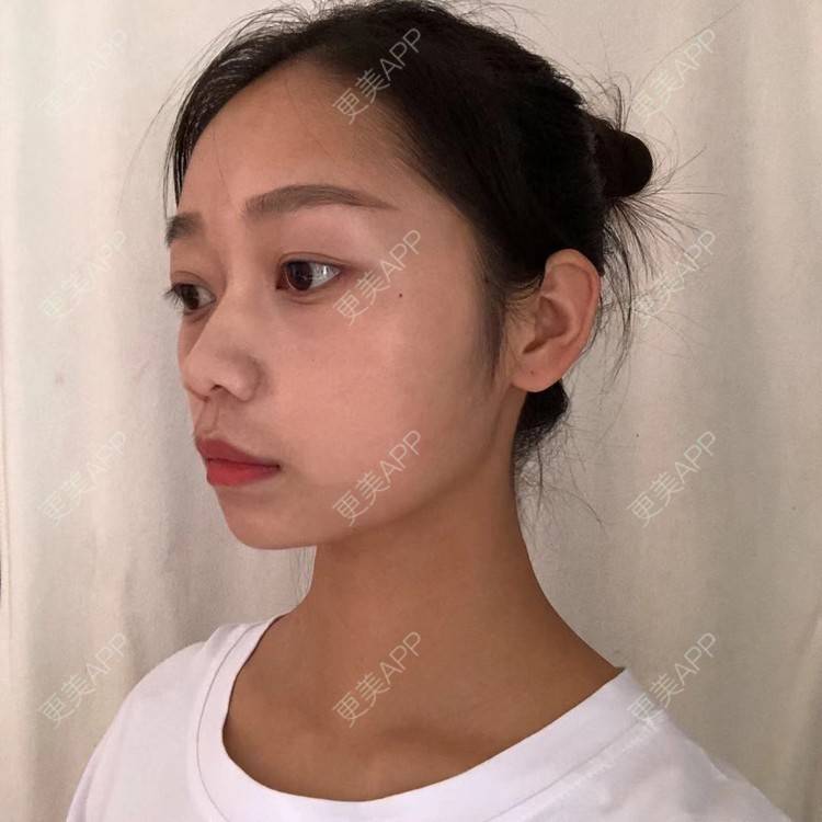 更美 - 更美用户1P9auHsFVF的水氧活肤经验 | 水氧活肤 | 长沙