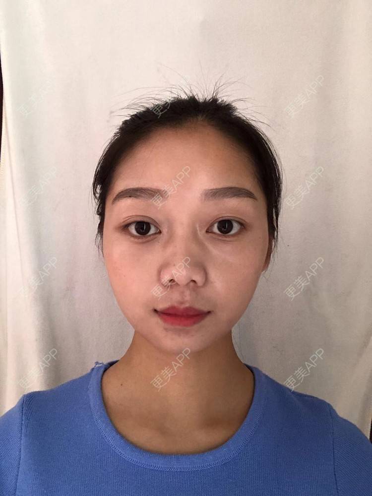 更美 - 更美用户1P9auHsFVF的水氧活肤经验 | 水氧活肤 | 长沙