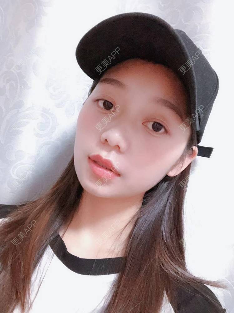 更美 - 更美用户1P9auHsFVF的水氧活肤经验 | 水氧活肤 | 长沙