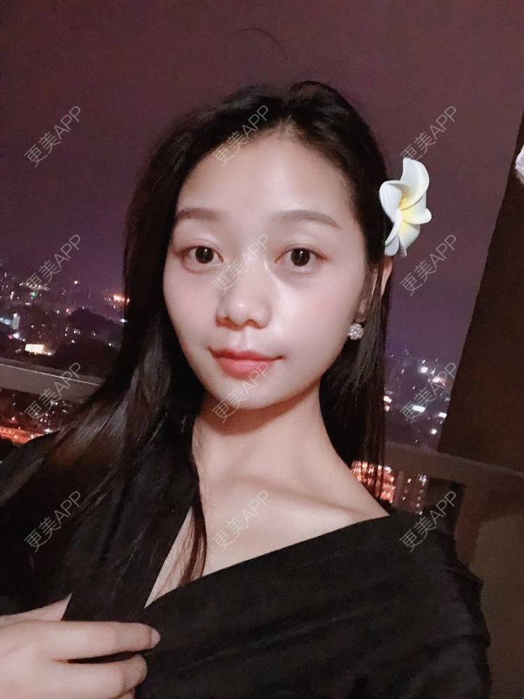 更美 - 更美用户1P9auHsFVF的水氧活肤经验 | 水氧活肤 | 长沙
