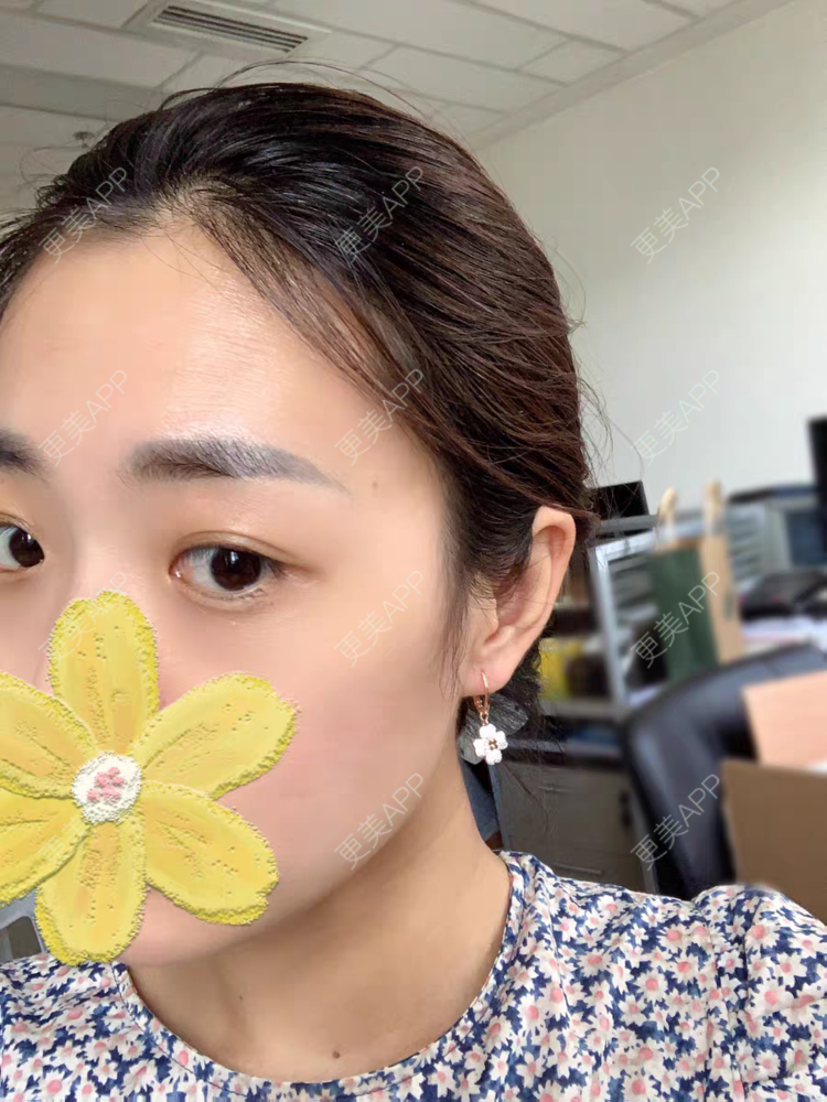 更美 - 我男神吴亦凡的眼部综合经验 | 眼部综合 | 西安