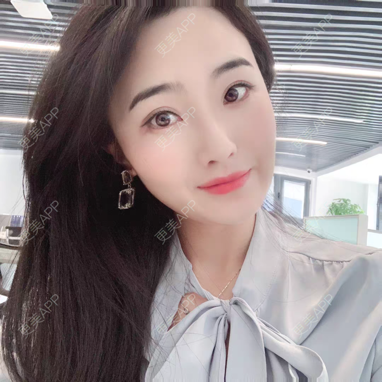 更美 - 自信能量爆棚的眼部多项经验 | 眼部多项 | 西安