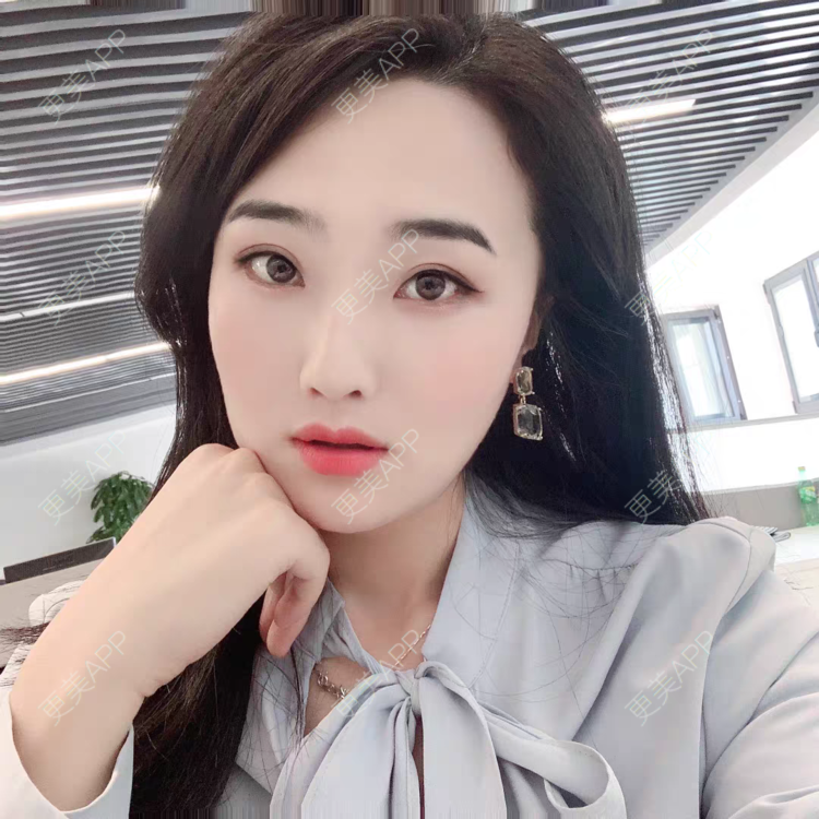 更美 - 自信能量爆棚的眼部多项经验 | 眼部多项 | 西安