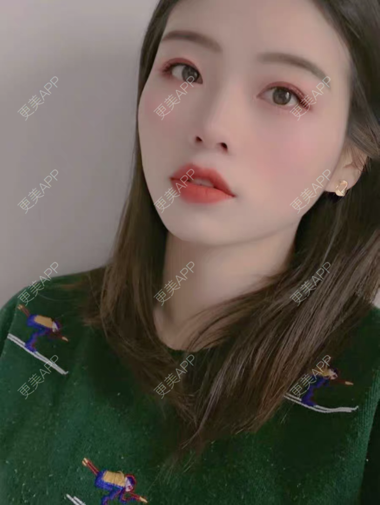 更美 - 娜娜不信命的眼部综合经验 | 眼部综合 | 西安