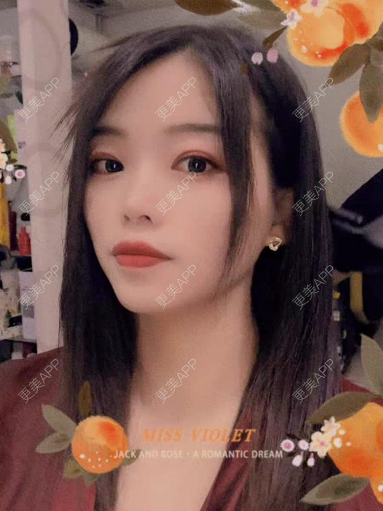 更美 - 娜娜不信命的眼部综合经验 | 眼部综合 | 西安