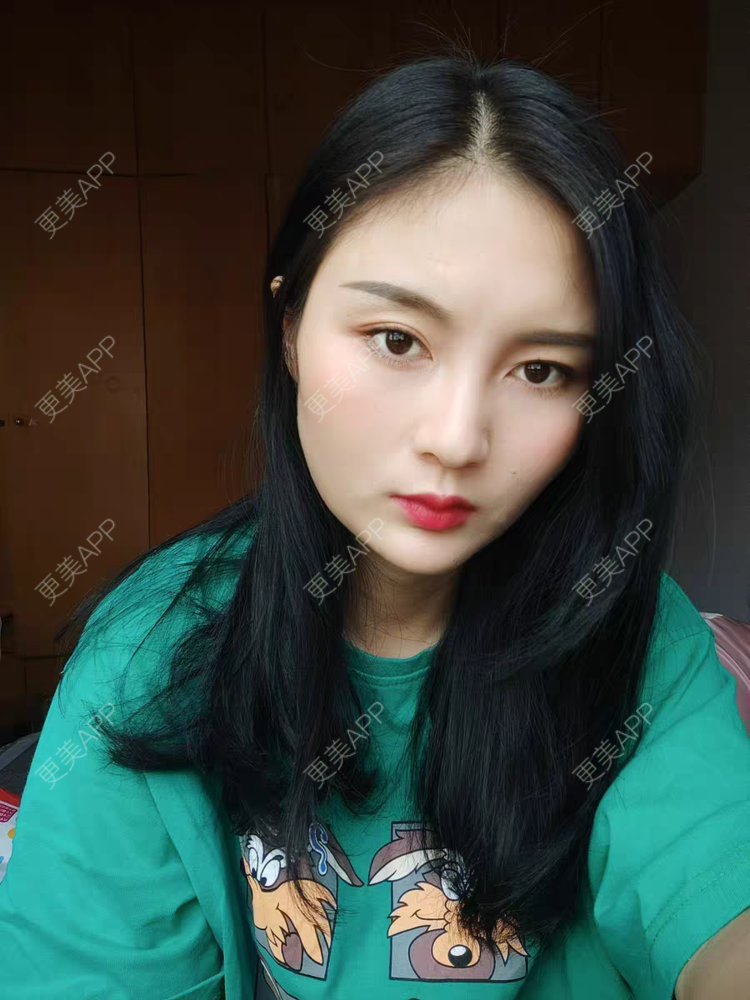 更美 - 爱你的kk的眼部多项经验 | 眼部多项 | 西安