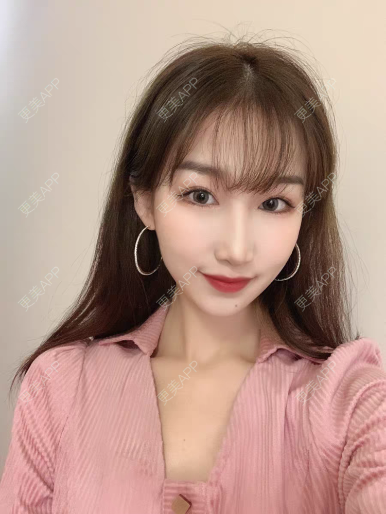 更美 - 美阿细的眼部多项经验 | 眼部多项 | 西安