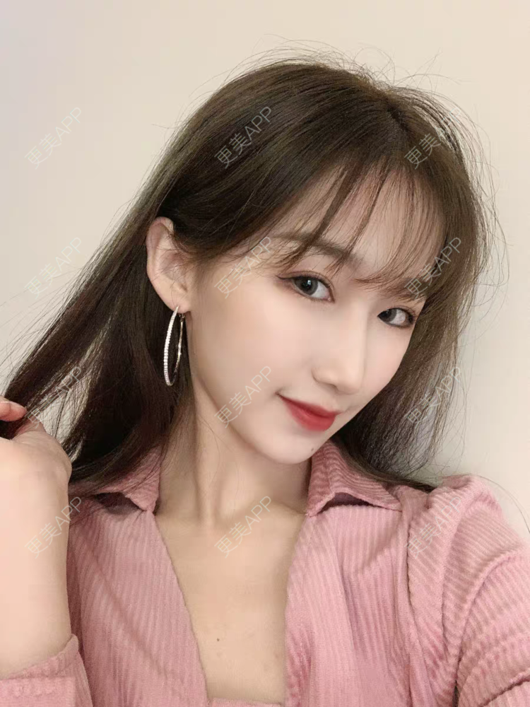 更美 - 美阿细的眼部多项经验 | 眼部多项 | 西安