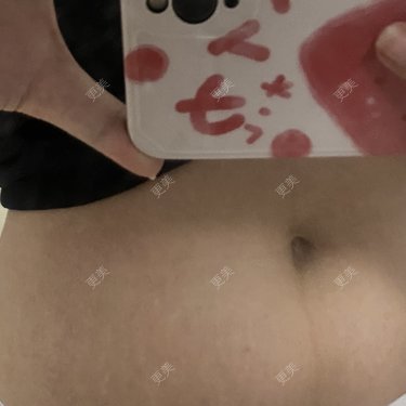 更美用户IgJbVKY5D0