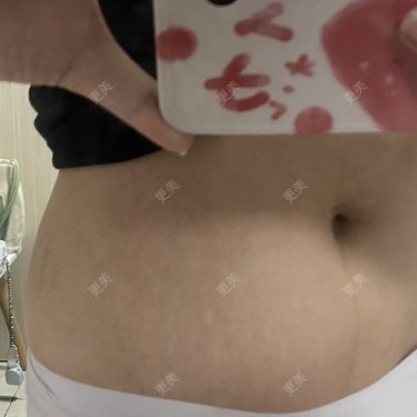更美用户IgJbVKY5D0