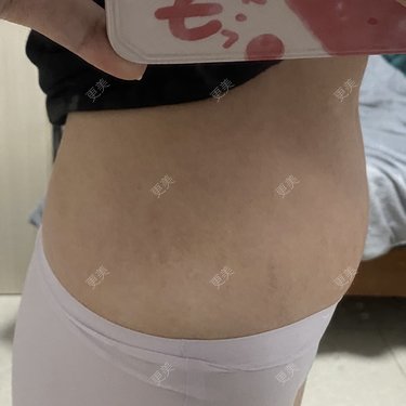 更美用户IgJbVKY5D0