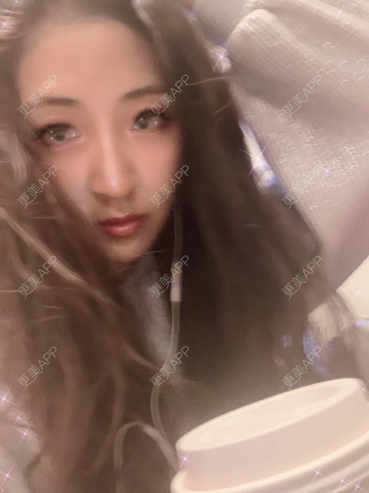 更美 - 房小丫的水光项目经验 | 水光项目 | 天津 | 微针水光