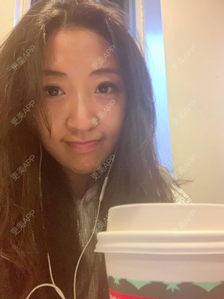 更美 - 房小丫的水光项目经验 | 水光项目 | 天津 | 微针水光