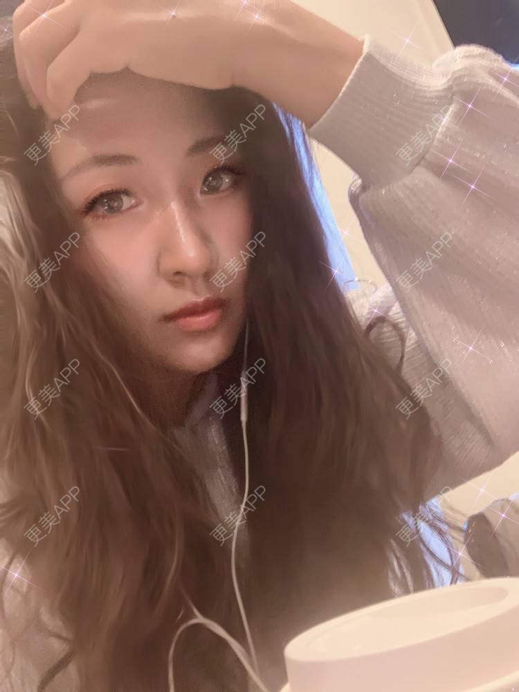 更美 - 房小丫的水光项目经验 | 水光项目 | 天津 | 微针水光