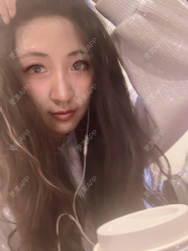 更美 - 房小丫的水光项目经验 | 水光项目 | 天津 | 微针水光