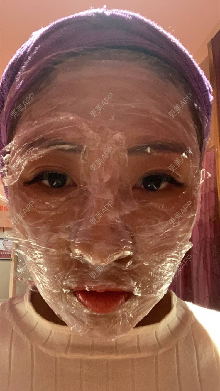 更美 - 房小丫的水光项目经验 | 天津 | 水光项目 | 微针水光