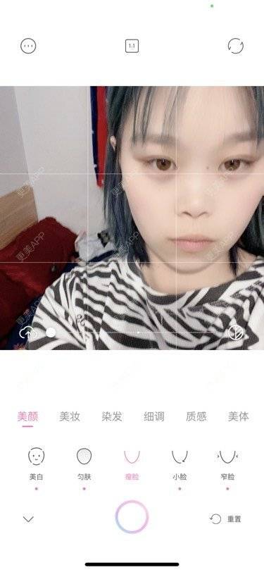 更美 - 情烈梦他ぃ的除皱瘦脸经验 | 除皱瘦脸 | 长春