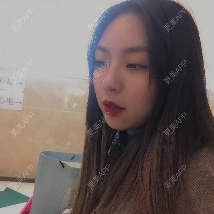 更美 - 吃飯從來用湯勺√的自体脂肪隆鼻经验 | 成都 | 自体脂肪隆鼻 | 视频日记