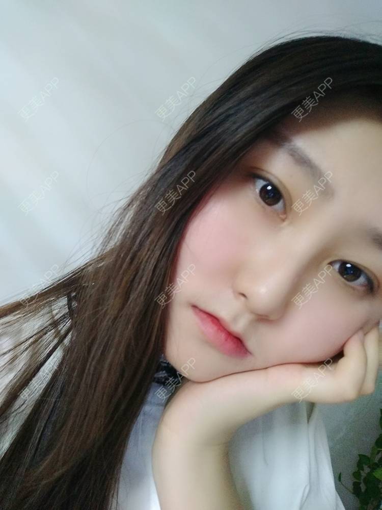 更美 - 更美用户zLnEttFeDx的热玛吉经验 | 广州 | 热玛吉