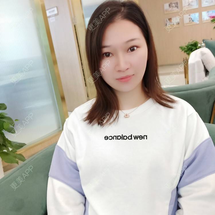 更美 - 优美酱的鼻部多项经验 | 肋软骨隆鼻 | 鼻部多项 | 鼻小柱延长 | 鼻部膨体假体取出 | 自体肋软骨垫鼻基底