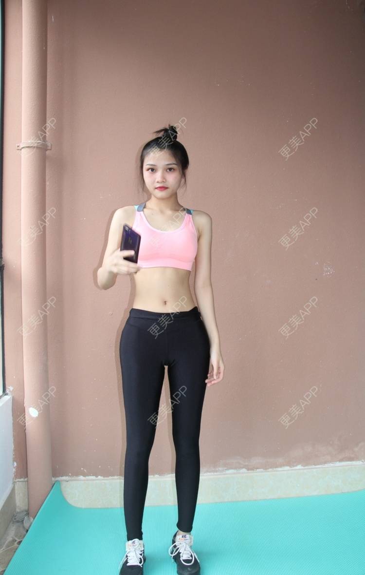 更美 - 超甜的布丁520的超声溶脂瘦腰部经验 | 射频溶脂 | 超声溶脂瘦腰部