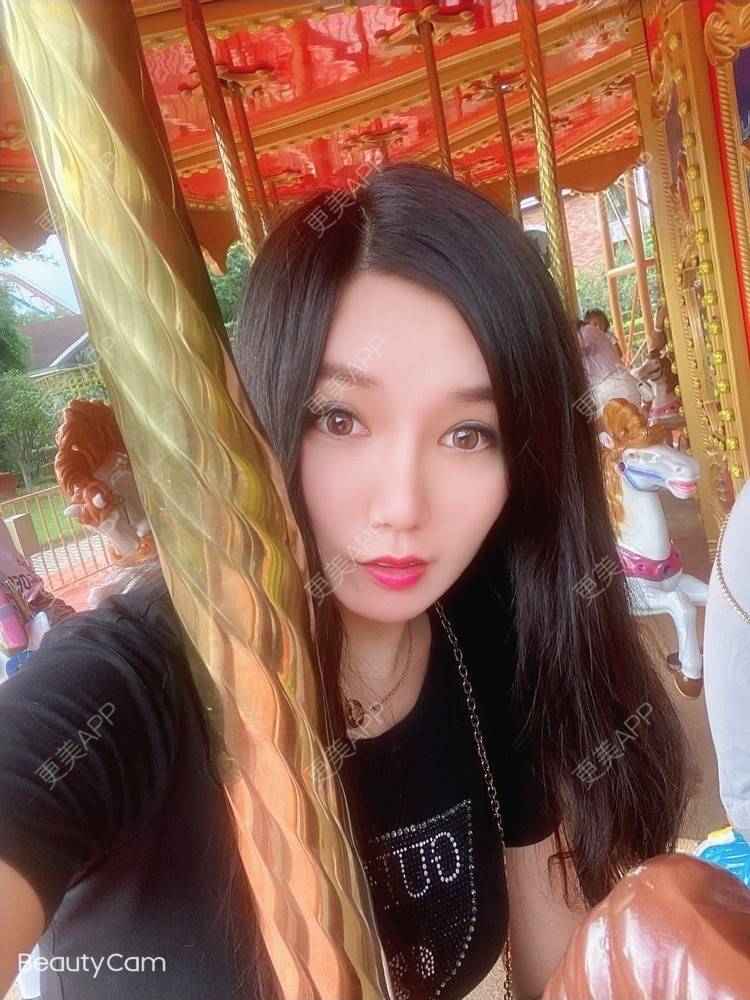 更美 - 傻傻傻分不清的硅胶垫下巴经验 | 硅胶垫下巴 | 上海