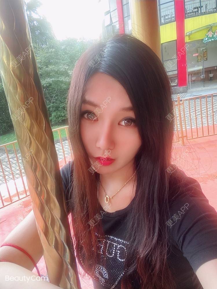 更美 - 傻傻傻分不清的硅胶垫下巴经验 | 硅胶垫下巴 | 上海