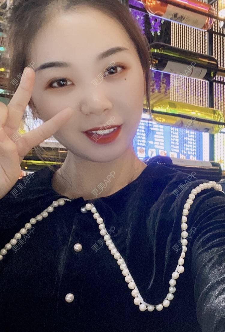 更美 - 河南美时美刻医疗美容的全切双眼皮经验 | 全切双眼皮
