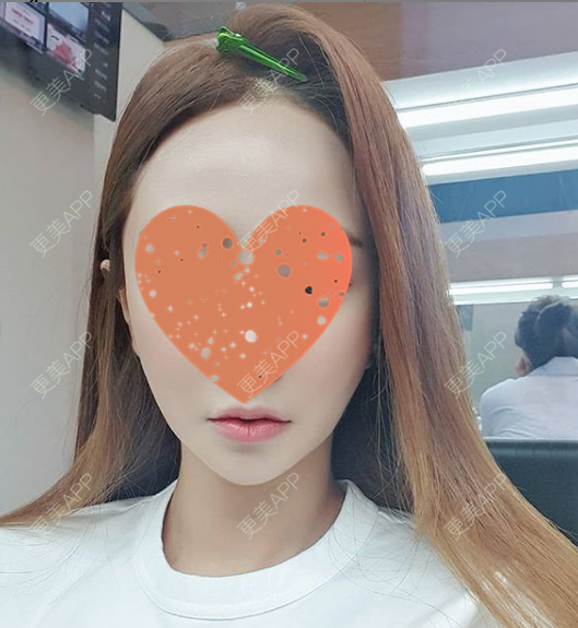 更美 - ︺槑萌藲夿つ蓉的下巴经验 | 北京 | 下巴