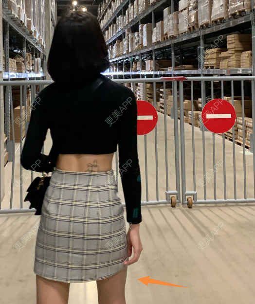 更美 - 更美用户vYv9CoVcFL的超声溶脂瘦大腿经验 | 超声溶脂 | 超声溶脂瘦大腿